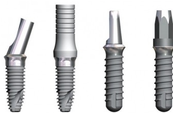 implant-dentar